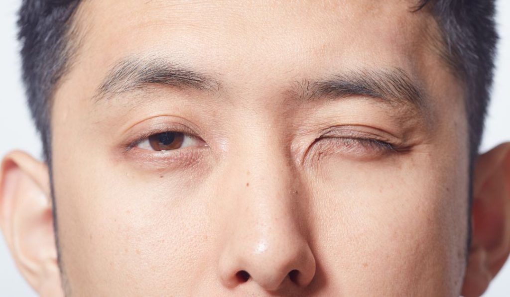 Man blinking his one eye.