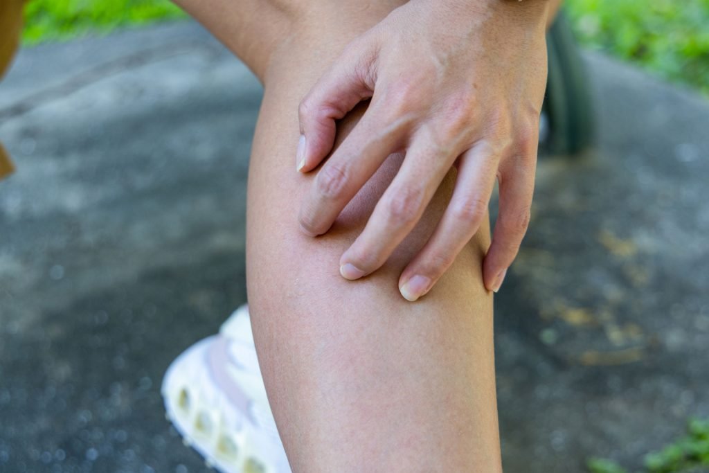 Calf of a woman having cramps.