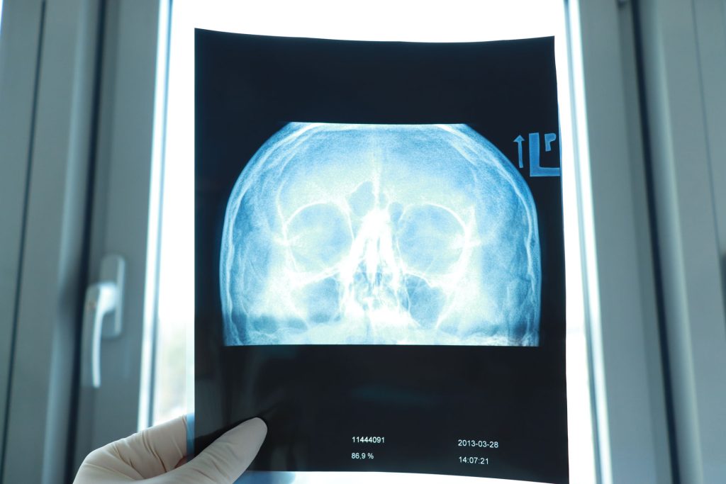Xray of the head to identify neurological conditions.