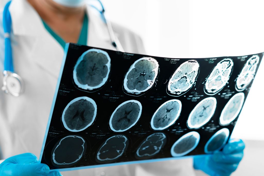 Doctor holding mri scan.