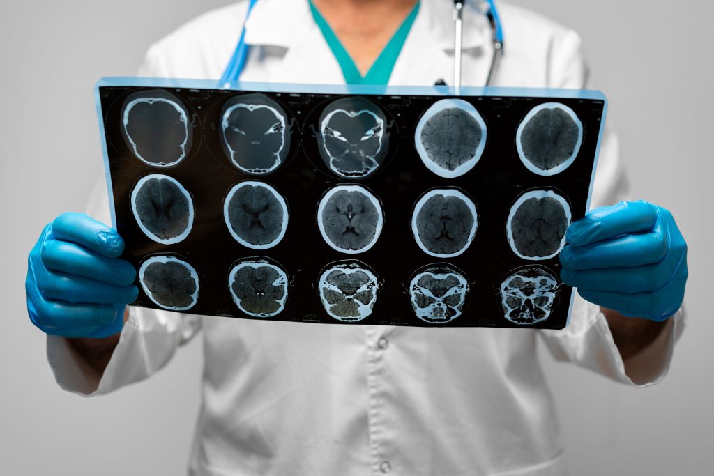 Doctor holding a MRI scan result.