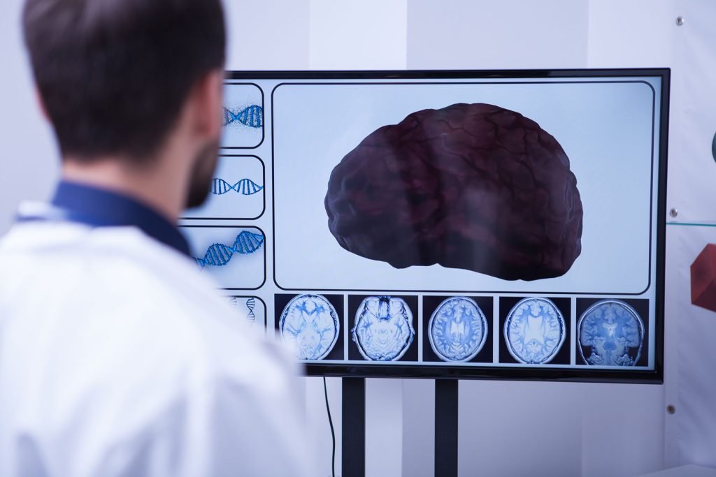Neurologist checking brain mri.