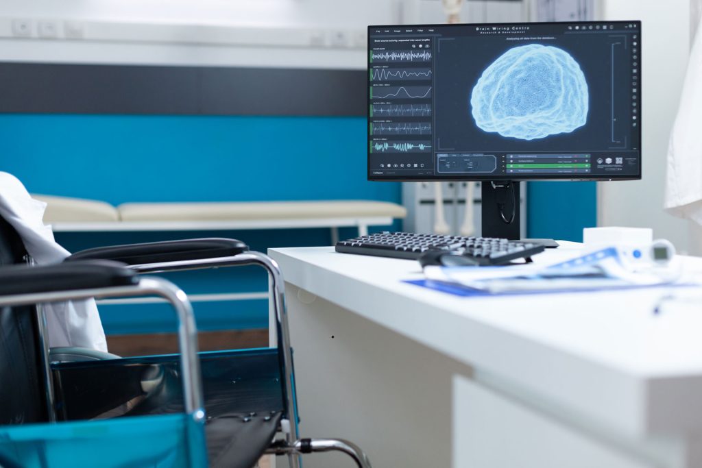 Computer on table with an image of a brain.