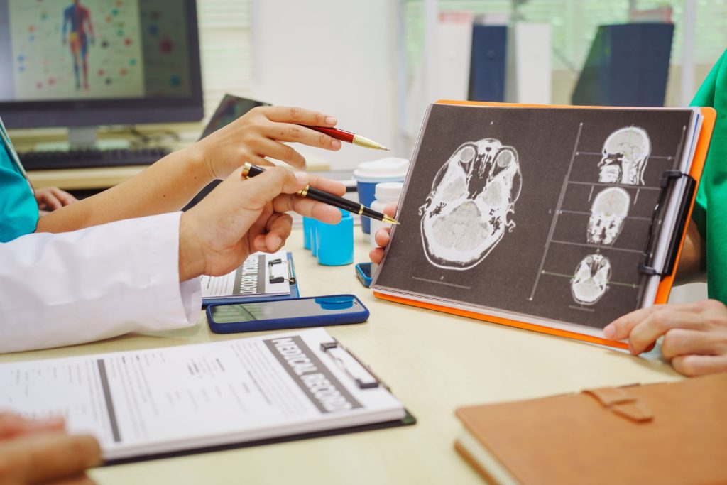 Doctors sit together at hospital desk pointing at MRI scan.